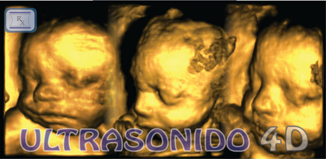 Realiza un ultrasonido 4D durante tu embarazo, Centro Integral de Diagnóstico Médico, Cd, del Carmen, Camp. México